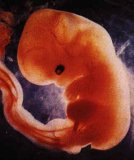 The growing brain of a foetus
